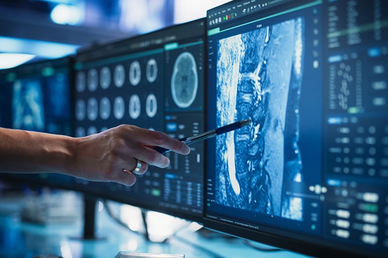 Santé et cancers