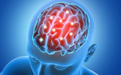 AVC (accident vasculaire cérébral)